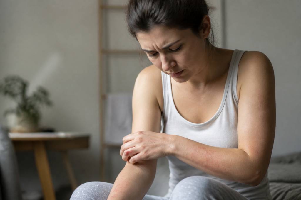 Comment savoir si on a la gale : signes et conseils pour agir rapidement